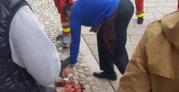 Tuča migranata danas na Baščaršiji, jedan povrijeđen