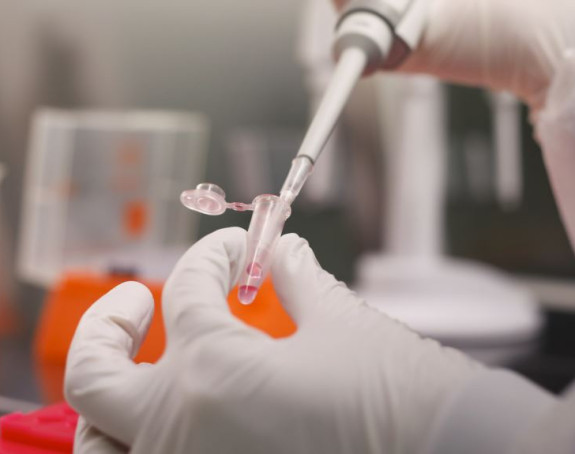 Lijek protiv HIV testiraju za liječenje korone
