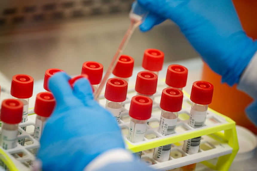 Testiranje vakcine za virus korona na oboljelom licu