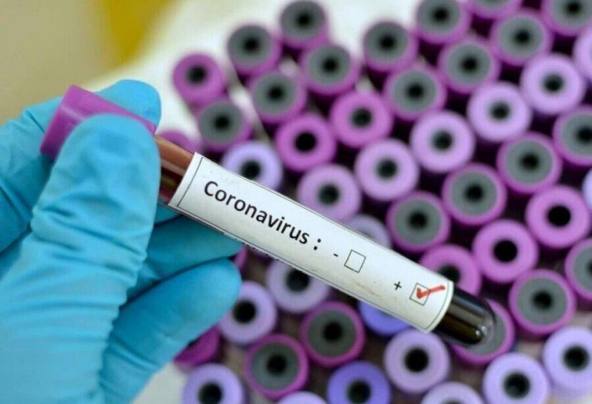 Novi slučaj zaraze virusom korona u Bosni i Hercegovini