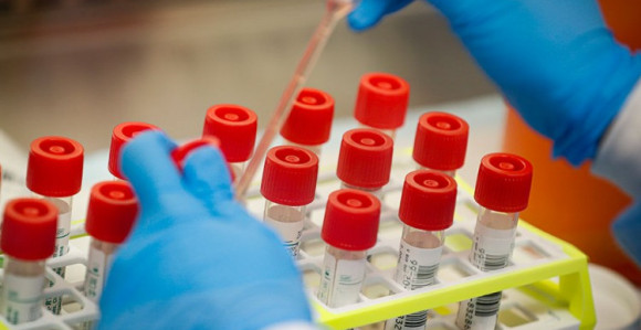 Testiranje vakcine za virus korona na oboljelom licu