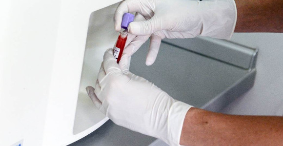 U Srbiji još dva slučaja zaraženih virusom korona