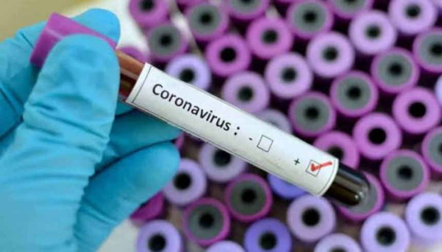 Virus korona potvrđen kod još dvije osobe u RS