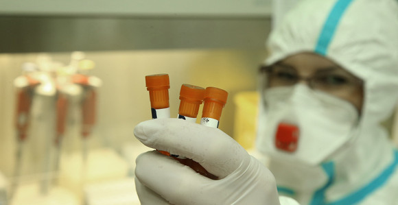 Još sedam osoba pozitivno na virus korona u Srpskoj