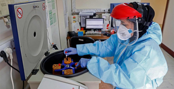 Obezbijeđene dvije laboratorijske opreme za testiranje