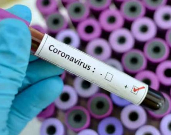 Virus korona potvrđen kod još dvije osobe u RS