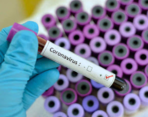 Virus nastavlja da napada rupe u sistemu sve jače i vidljivije