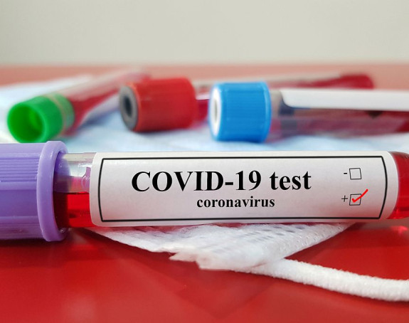 Tri nova slučaja u BiH, virus korona ušao i u EUFOR