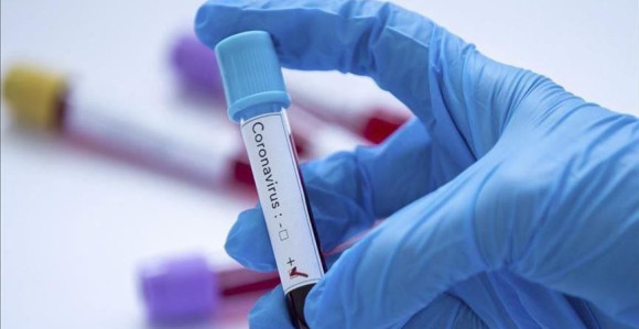 Među zaraženim u Širokom Brijegu i jedna beba