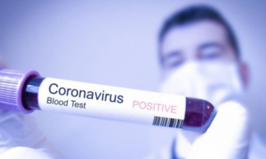 Tri nova slučaja virusa korona u Širokom Brijegu