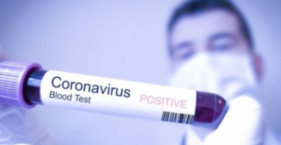 Tri nova slučaja virusa korona u Širokom Brijegu