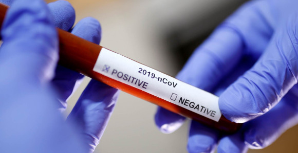 Još dva nova slučaja zaraze virusa korona u FBiH