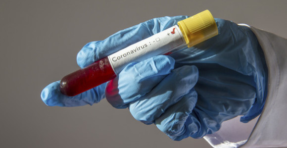Dva epidemiologa oboljela su od virusa korona