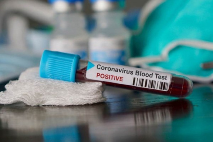 Cijela porodica iz Viteza zaražena na virus koorna