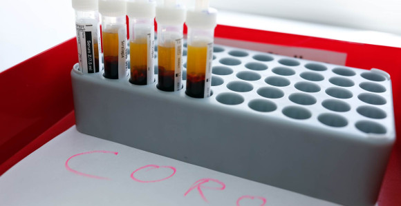 U BiH još šest slučajeva pozitivno na virus korona