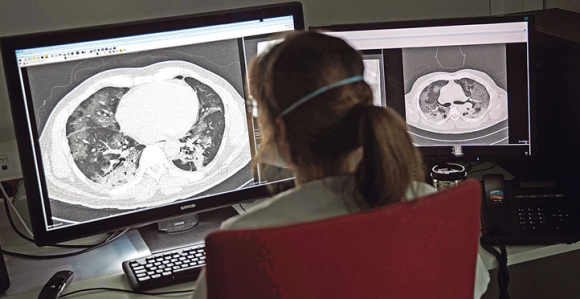 Шта корона ради организму: Напада плућа, бубреге...