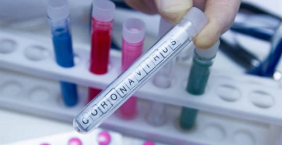 Novozaraženih 16 u ZHK, od čega je 15 oboljelih iz Čitluka