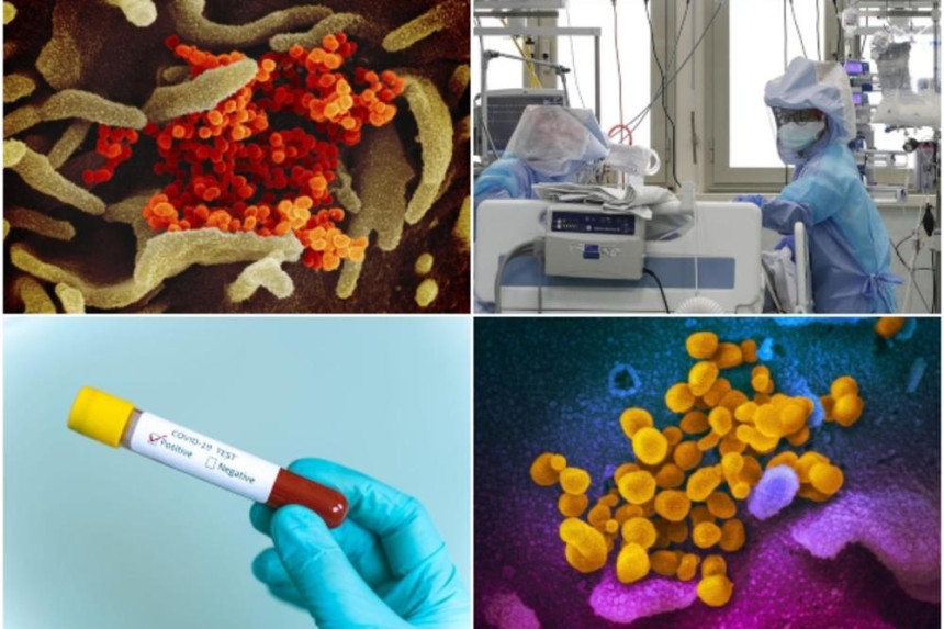 Научници тврде: Три соја корона вируса се шири свијетом