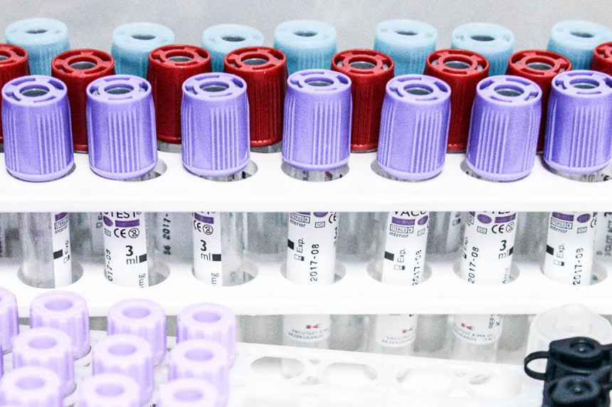 Broj zaraženih virusom korona povećava se u BiH