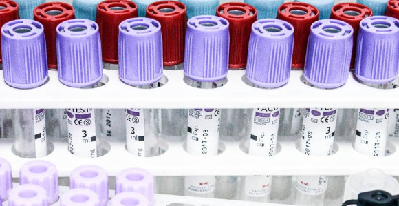 Broj zaraženih virusom korona povećava se u BiH