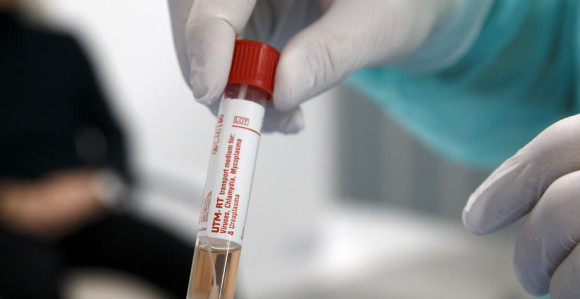 Велики број тестирања у БиХ, четири особе позитивне