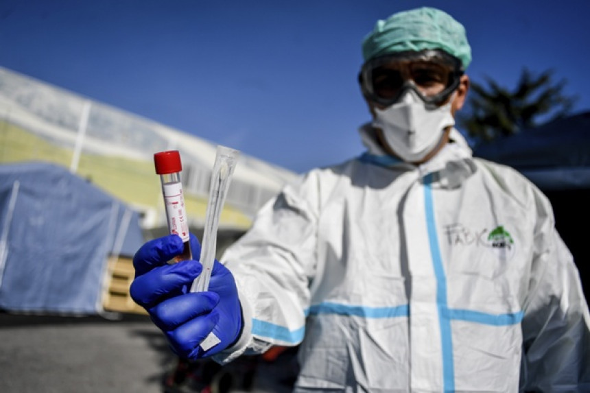 "U koroni ima HIV čestica izašlh iz laboratorije"