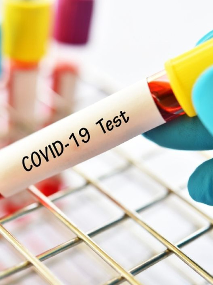 Beograd poklonio Prištini testove za virus korona