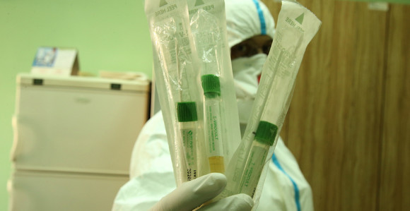 U BiH na virus korona pozitivno 1.285 osoba