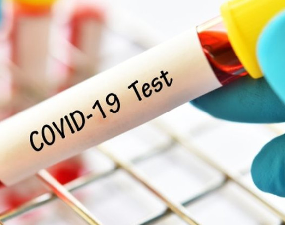 Beograd poklonio Prištini testove za virus korona