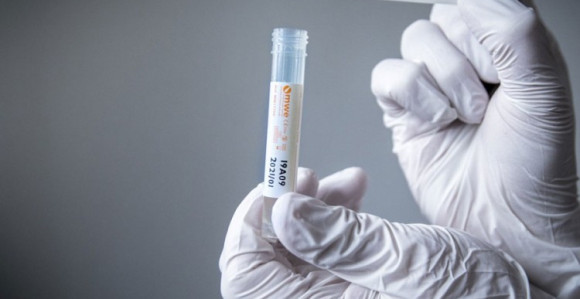 U Srpskoj još 11 osoba pozitivno na virus korona