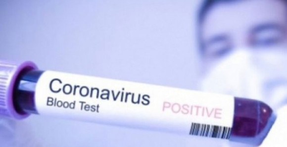 Još četiri osobe zaražene virusom korona u FBiH