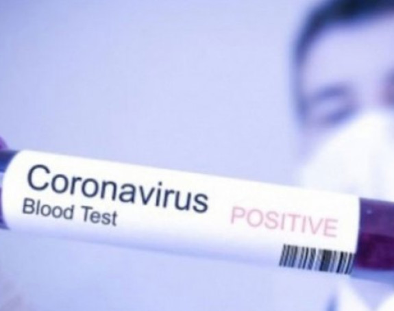 Još četiri osobe zaražene virusom korona u FBiH