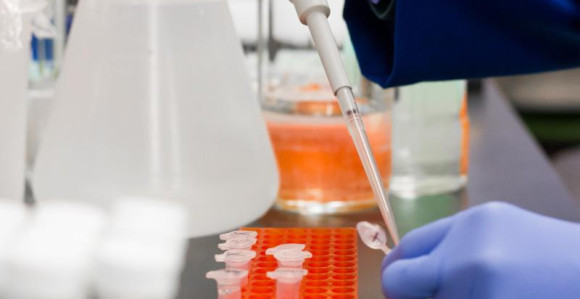 Virus se širi samo kontaktom sa zaraženom osobom