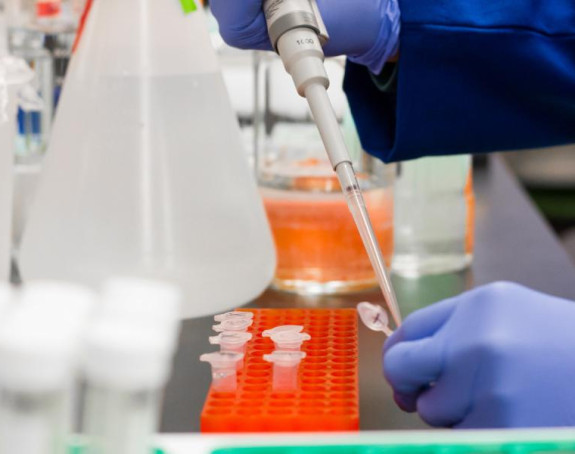 Virus se širi samo kontaktom sa zaraženom osobom