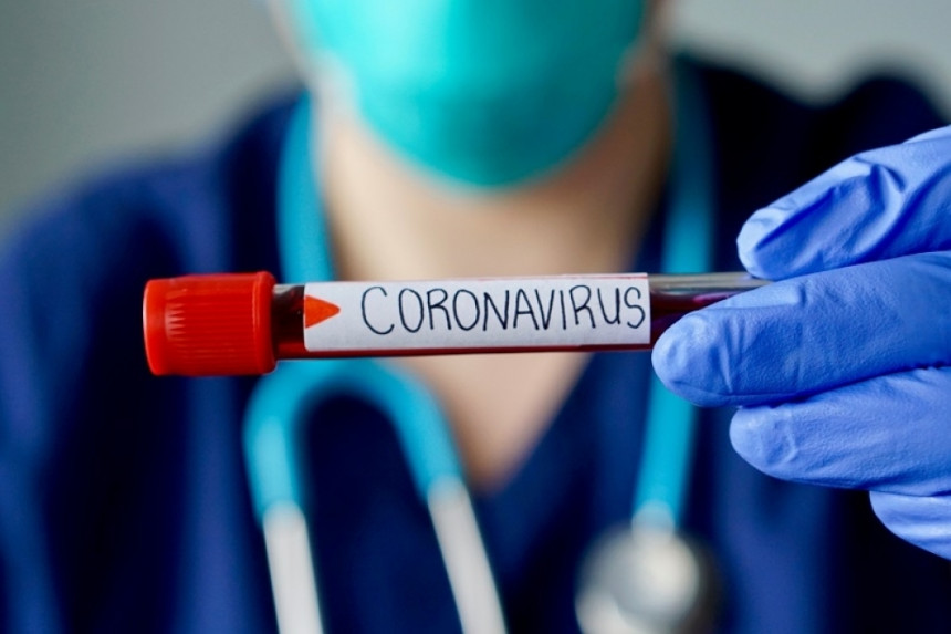 U Republici Srpskoj 39 novih slučajeva virusa korona