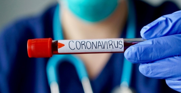 U Republici Srpskoj 39 novih slučajeva virusa korona