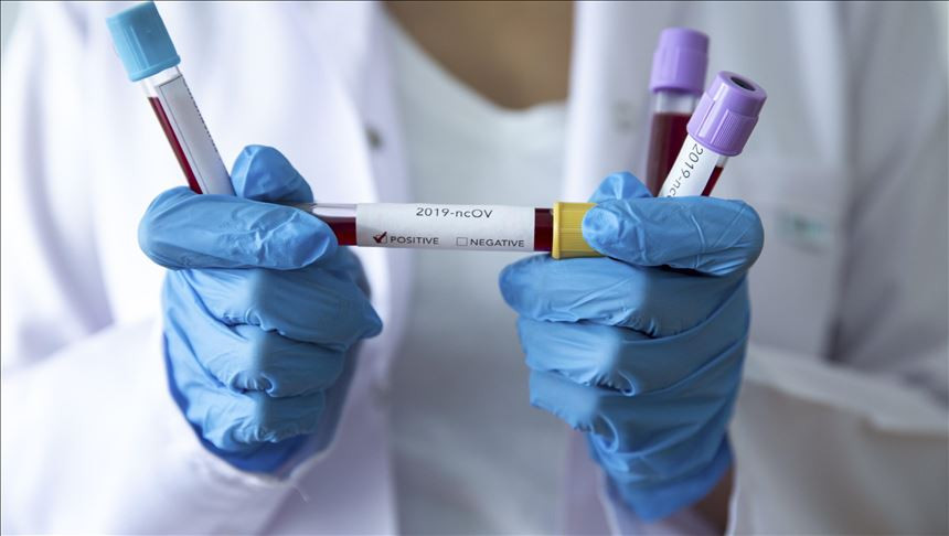 U FBiH 15 novih oboljelih od virusa korona