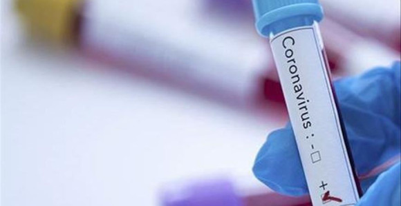 Na virus korona pozitivno je ukupno 1.516 osoba u BiH