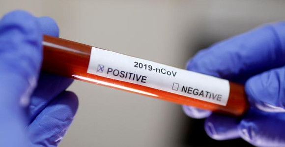 Dva nova slučaja zaraze virusa korona u Mostaru