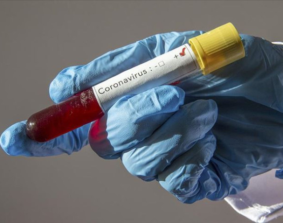 U Federaciji BiH 18 pozitivnih na virus korona