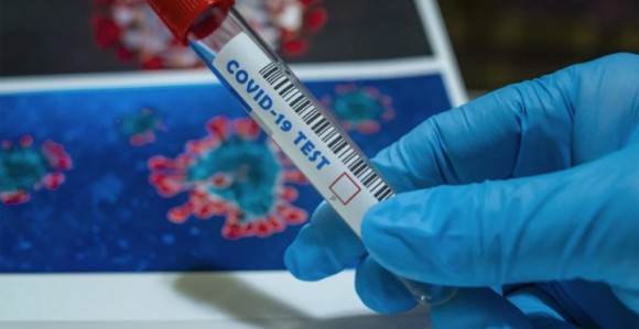 U FBiH još 34 osobe pozitivne na virus korona