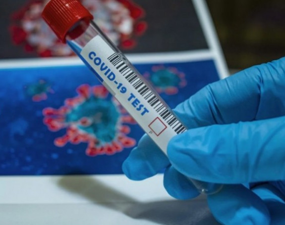 U FBiH još 34 osobe pozitivne na virus korona