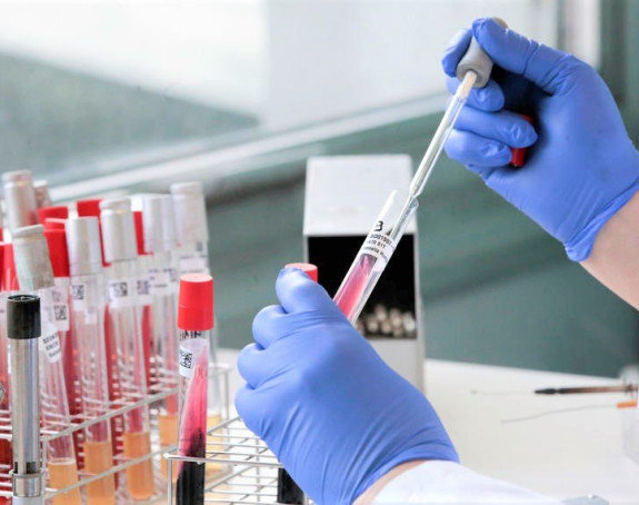 U Srbiji počinje masovno testiranje stanovništva