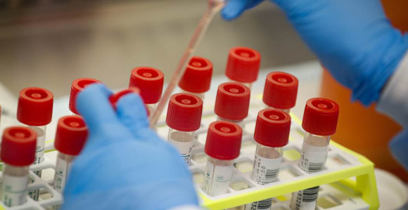 Svi koji žele da uđu u Hrvatsku moraće na testiranje