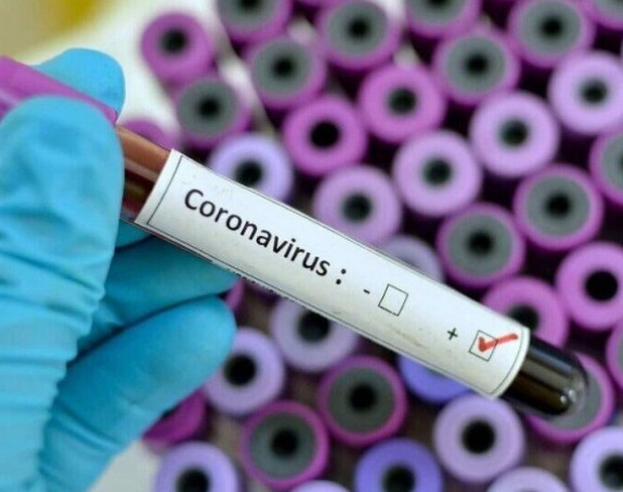 Novooboljelih 95 u Srbiji, dok su još tri osobe preminule