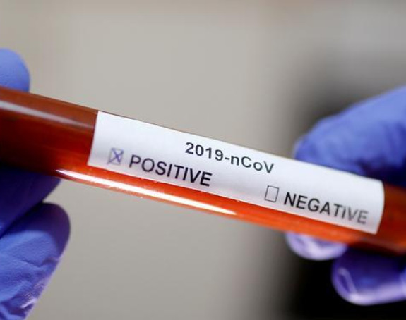 Novih 19 slučajeva zaraze virusom korona u Republici Srpskoj