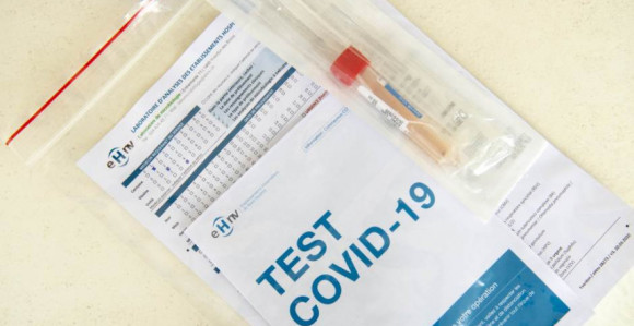 SDS: Osloboditi studente da plaćaju test na koronu