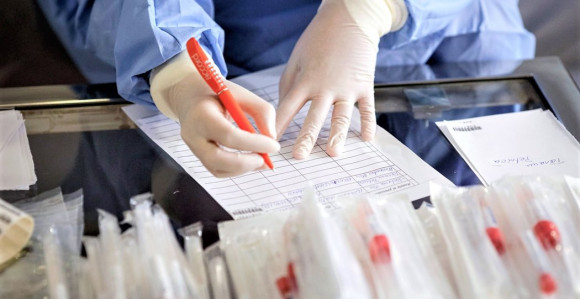 Cijene testova u zemljama u kojima se najčešće ljetuje