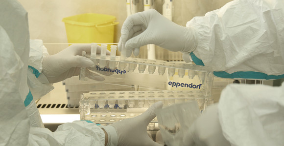 Virus korona potvrđen kod još 27 osoba u Republici Srpskoj