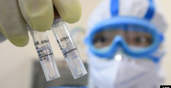 U Federaciji BiH od testiranih 638 nije bilo zaraženih